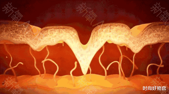 时尚好物官|那些敢于尝试“美容针”的女人，最后怎么样了？过来人说出心里话