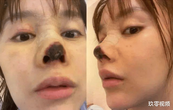 刘亦菲|“山寨刘亦菲”,19岁花百万整容,连名字也是高仿,今长成这样