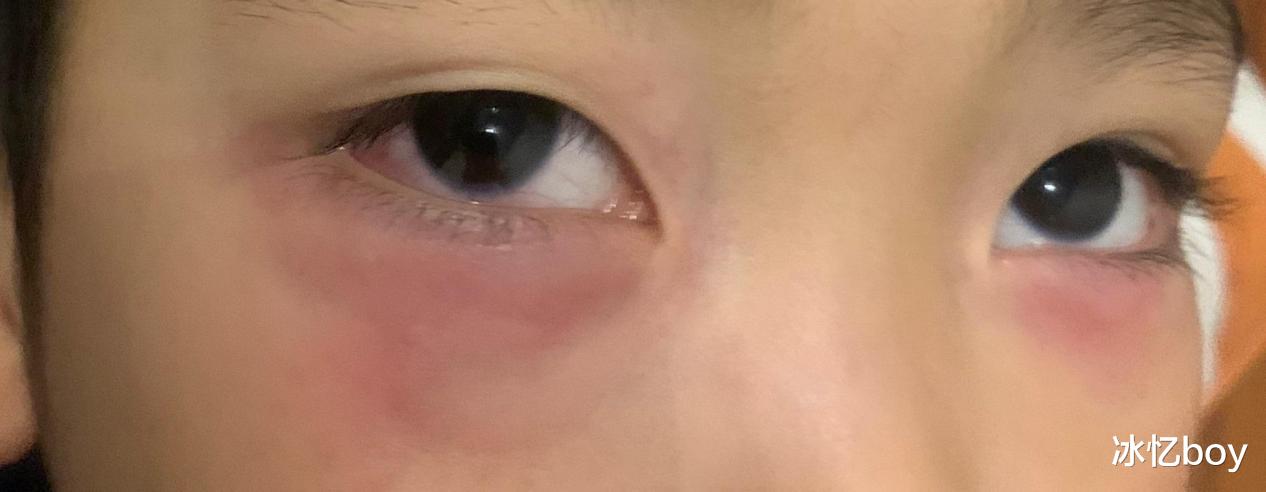 脾胃|WHO组织呼吁：停止使用1“空气炸锅”，再不停用，孩子脾胃“烂如渔网”