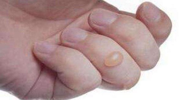 生活美学家 3岁男宝跌进170度油锅,奶奶这一做法太及时,医生都称赞其专业