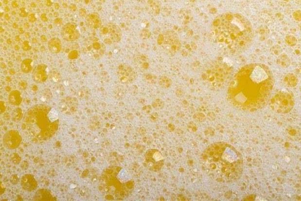 黄芪|尿液中有泡沫，是尿毒症的信号？4个方法帮你远离尿毒症！