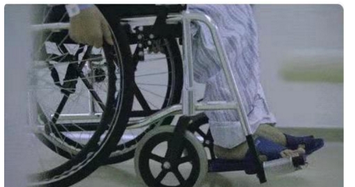 無名可取 去年那个刷爆全网，脊椎折叠28年的“弯曲人”李华，如今怎样？