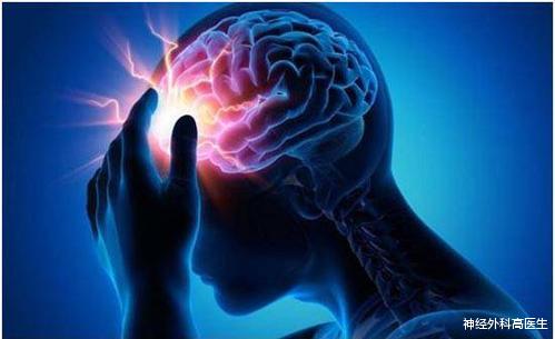 神经外科高医生 脑动脉瘤做CT能查出来吗