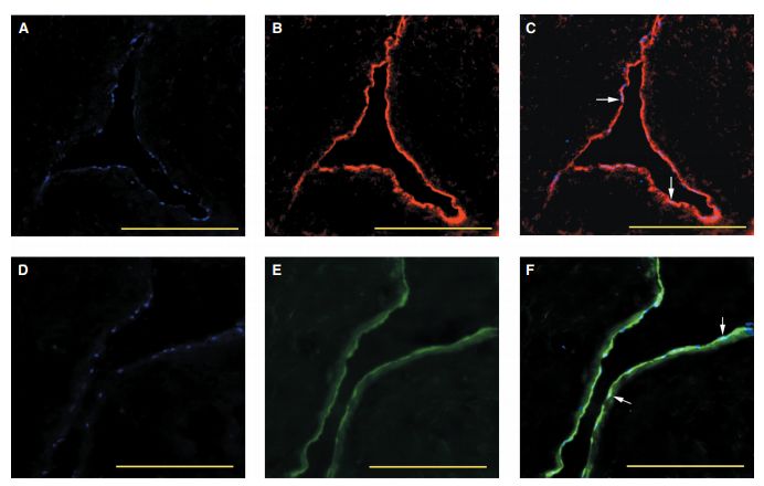 景焕粒子能|粒子能细胞康复液可修复损伤的血管,预防动脉粥样硬化!
