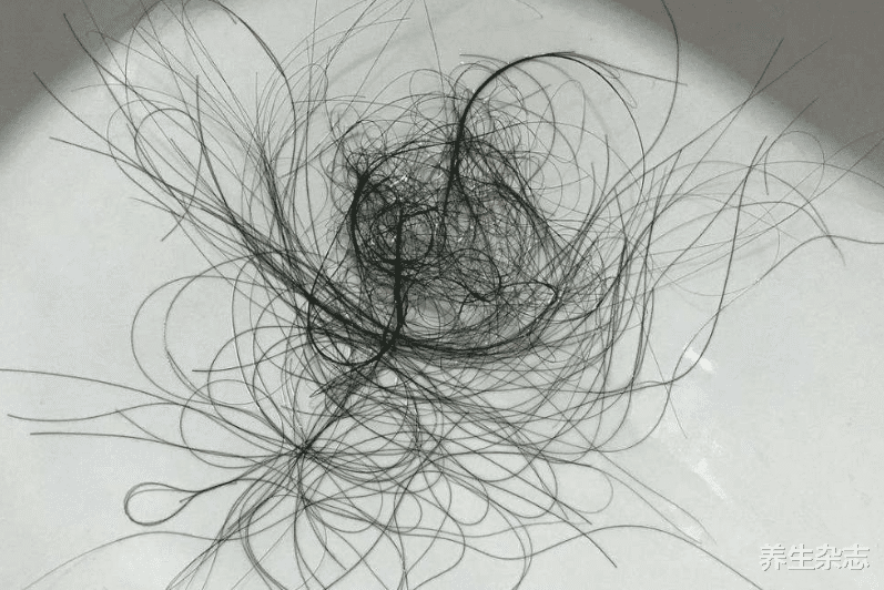 高血脂|甲状腺不会无缘无故“罢工”,若出现3种症状,结节正“藏”在体内