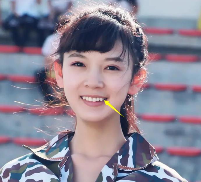 刘涛|明星“假牙”大pk：刘涛花300万整牙，吴昕的牙齿变黢黑