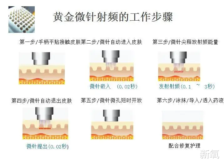 明星|为什么18岁的惊艳美少年40岁全变成油腻猥琐大叔？