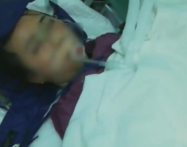 微影说红楼 遵义女子到长沙整形，昏迷半个月未醒，整形医院：不是医疗事故！