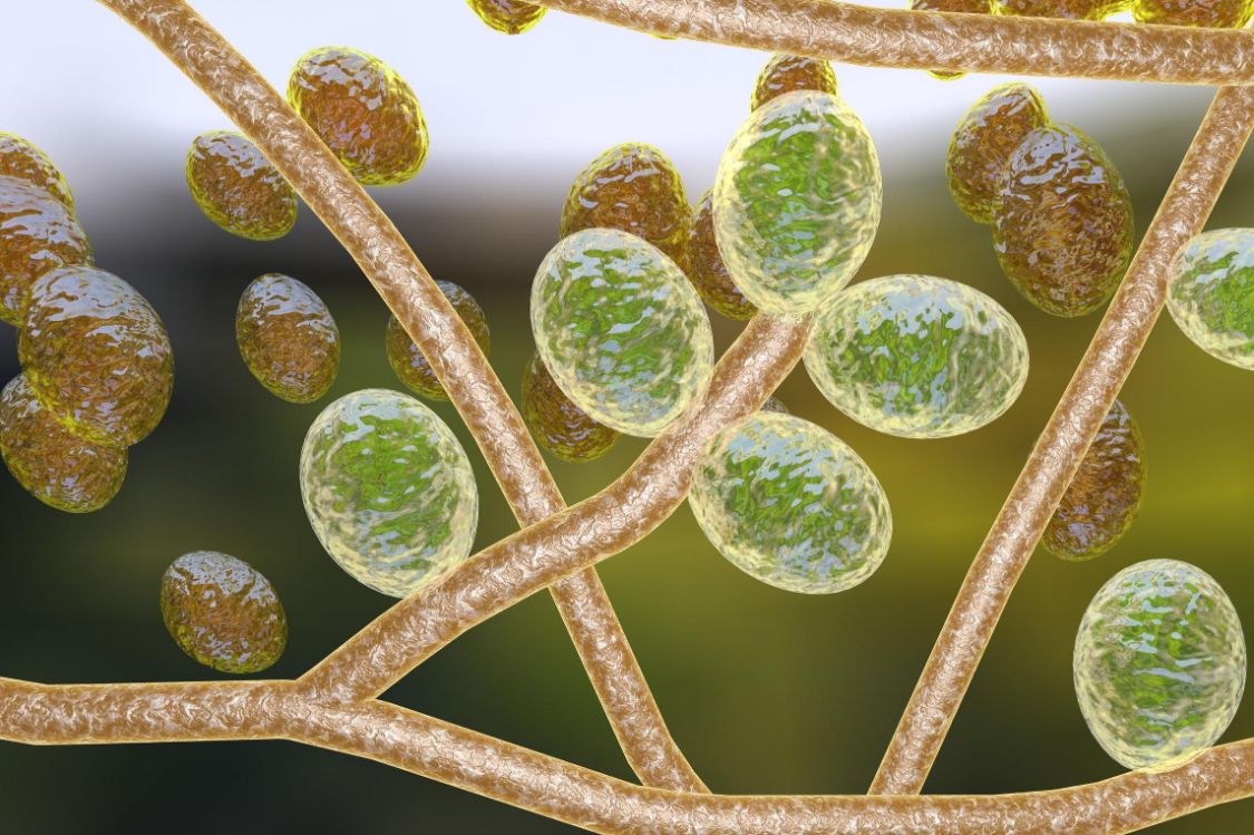 癌细胞|专家提示:若皮肤出现这些异常,或是体内有癌细胞的表现,需警惕