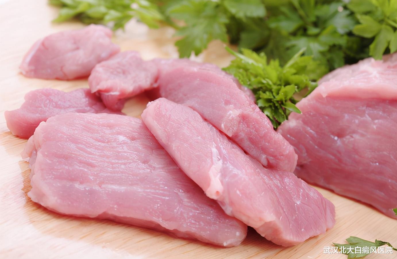 武汉北大白癜风医院|清淡饮食不是只吃素！这些肉类，白癜风患者还需吃些