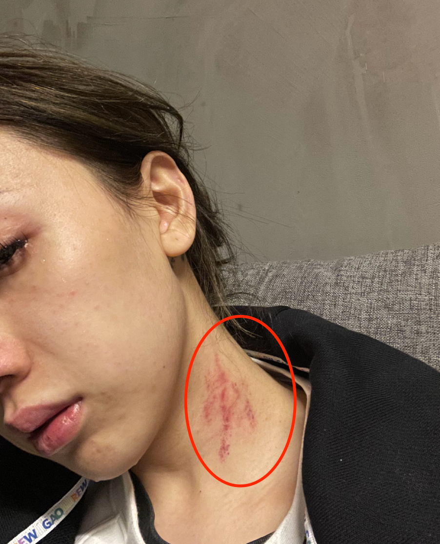 FreeC|歌手FreeC曝前任家暴！脸上被吐口水耳膜穿孔，染病后独自做手术