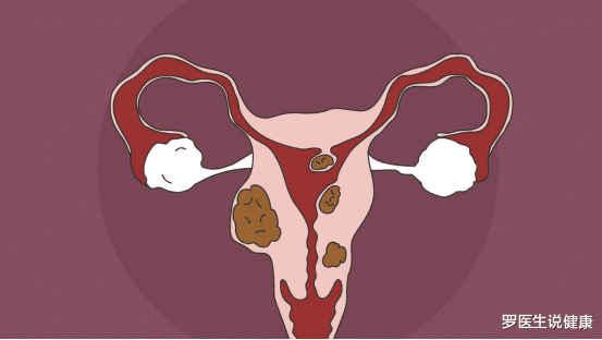 罗医生说健康|吃一口等于8斤红糖，妇科主任：女性常吃，活血化瘀，子宫肌瘤或会慢慢消散