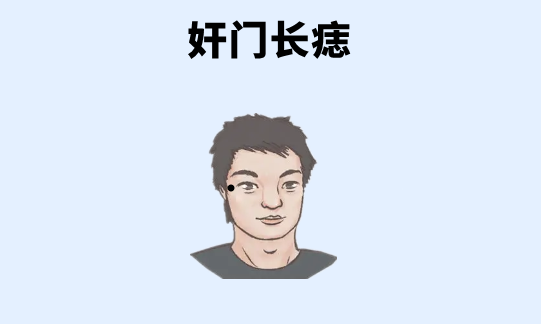 中国易经风水 身上4颗“穷酸”痣要不得,破财添灾,事业不顺,必须去掉!