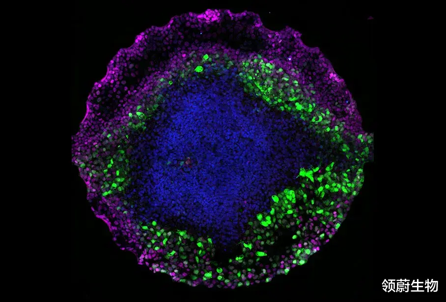 科学家 60W干细胞抗衰针打出肿瘤？被误伤的间充质干细胞有话说