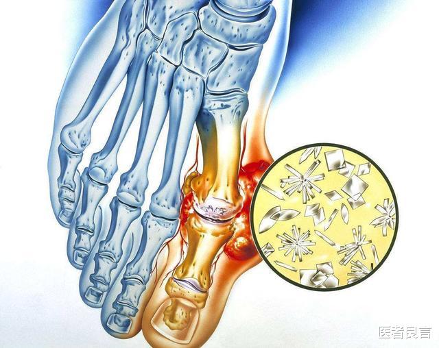 医者良言 农村老话“一个猪肚三副药”是什么意思？有科学依据吗？