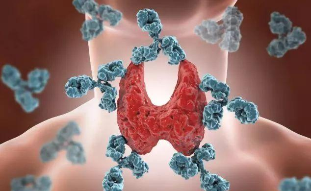 甲状腺结节|不少人爱吃的一种调味料,比烟酒还伤甲状腺!医生怒斥:少往嘴里送