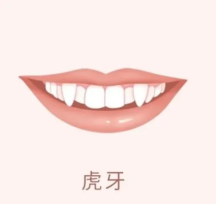 银川芽芽|你一定要知道的口腔趣味冷知识