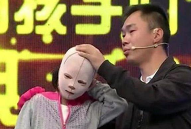 女孩从小就戴头套上学,受尽嘲笑与侮辱,摘下头套后全体沉默