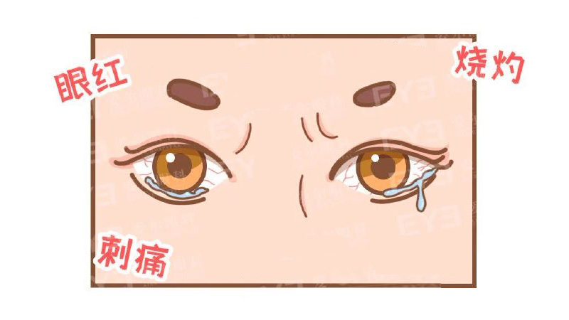 衡水爱尔眼科医院 眼睛里总有红血丝？大多属于这几种情况