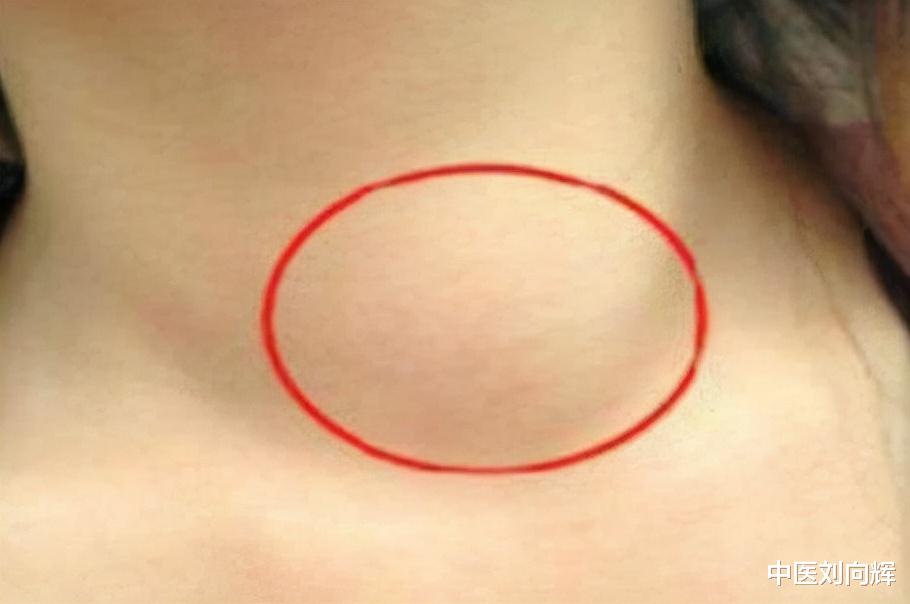 中药|世上本无病，只是痰和淤，简单两味中药，化痰又化瘀