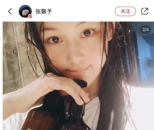 古力娜扎 娜扎从“脱发”恢复到“发量惊人”，分享的自用“生发法”火了，张馨予：靠谱国货