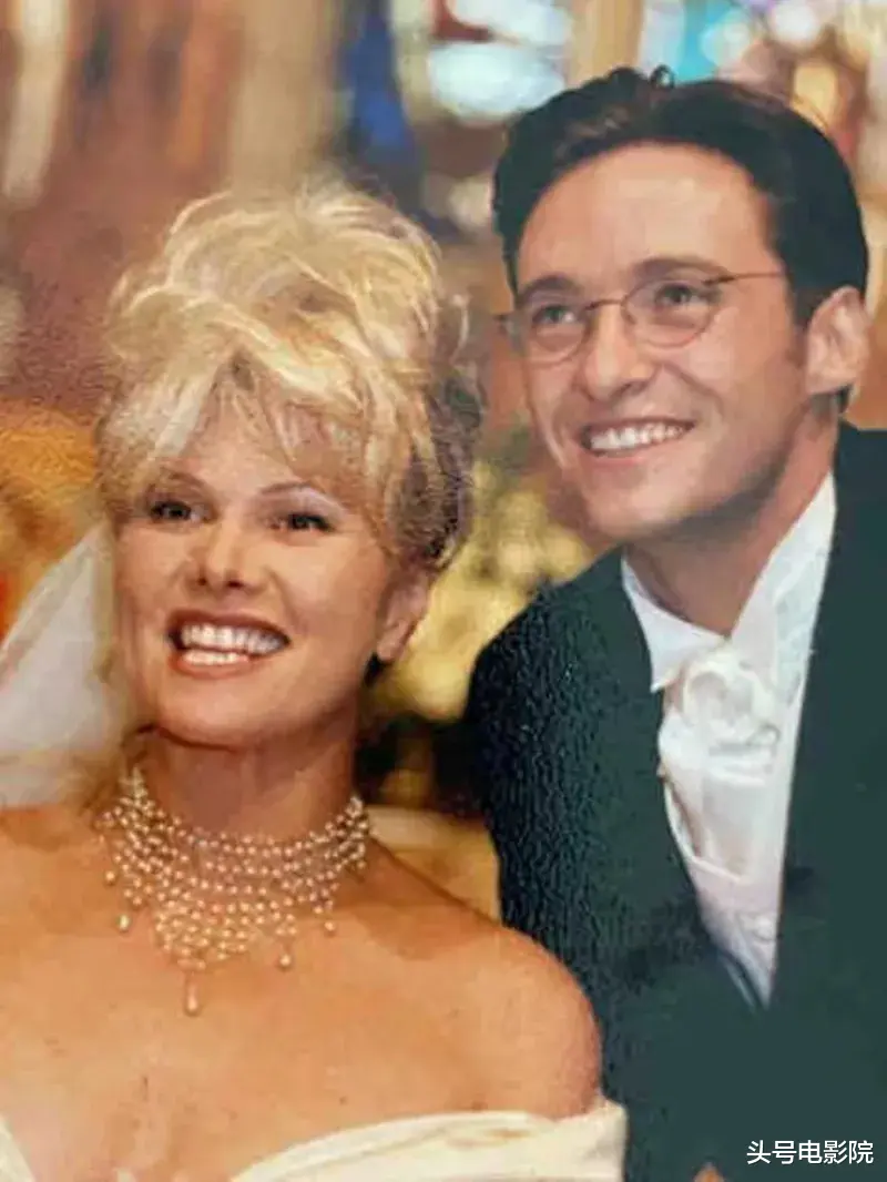 金刚狼|再爆皮肤癌危机！53岁金刚狼接受活检，与大13岁老婆结婚25年无孩