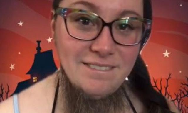 美国|美国女子毛发旺盛，曾感到很羞愧，如今大方晒出胡子觉得自豪