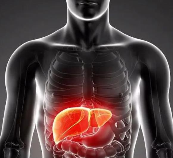 米饭|米饭或是脂肪肝的“发物”？内科医生：要想养好肝，3物请少吃