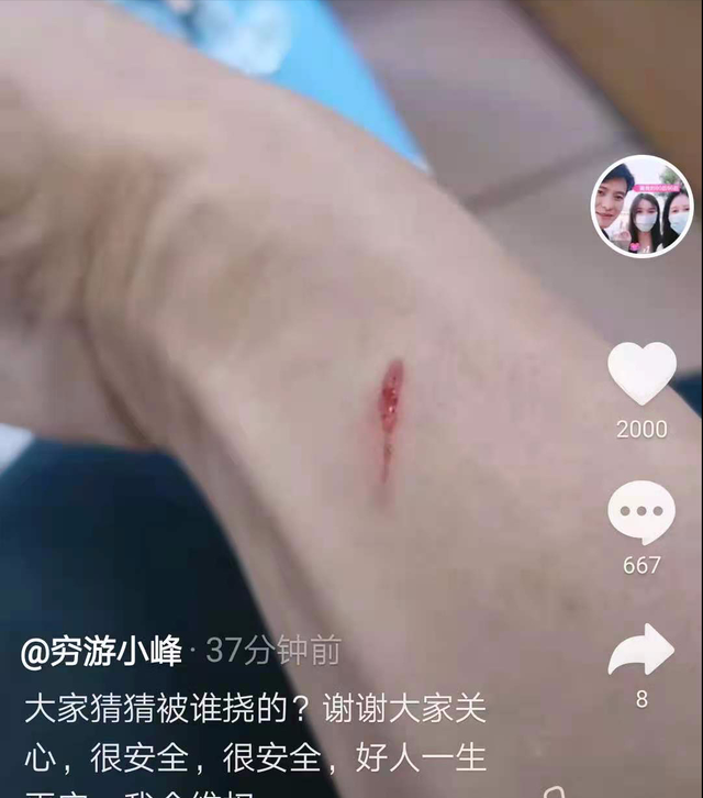 抚州 错换人生案：小峰还原事件经过后，为何杨姐承认是他们跟踪小峰了