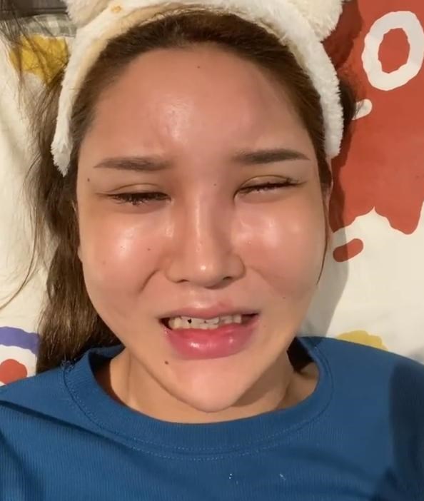 整容|女网红整容后感染，额头肿胀下巴变形，还想要“嘟嘟唇”吗？