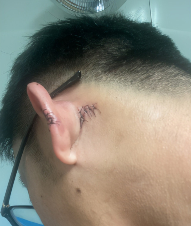 热点微评社 胡搅蛮缠！游客在“浴室内摔伤”索赔6000元：酒店欺负外地人！