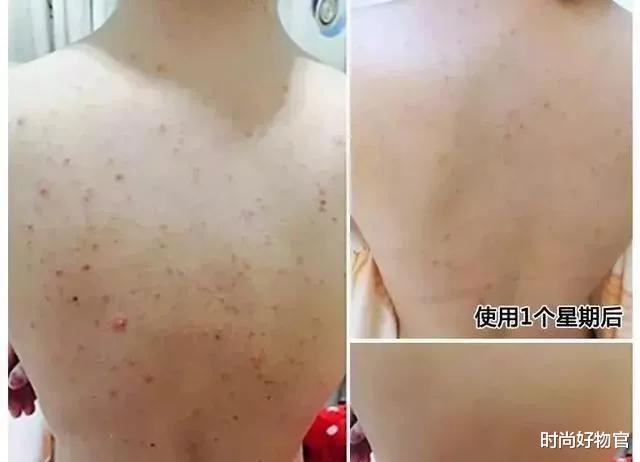 何超仪|赌王44岁女儿何超仪像外国人？皮肤白皙似18，有钱保养肌肤逆生长