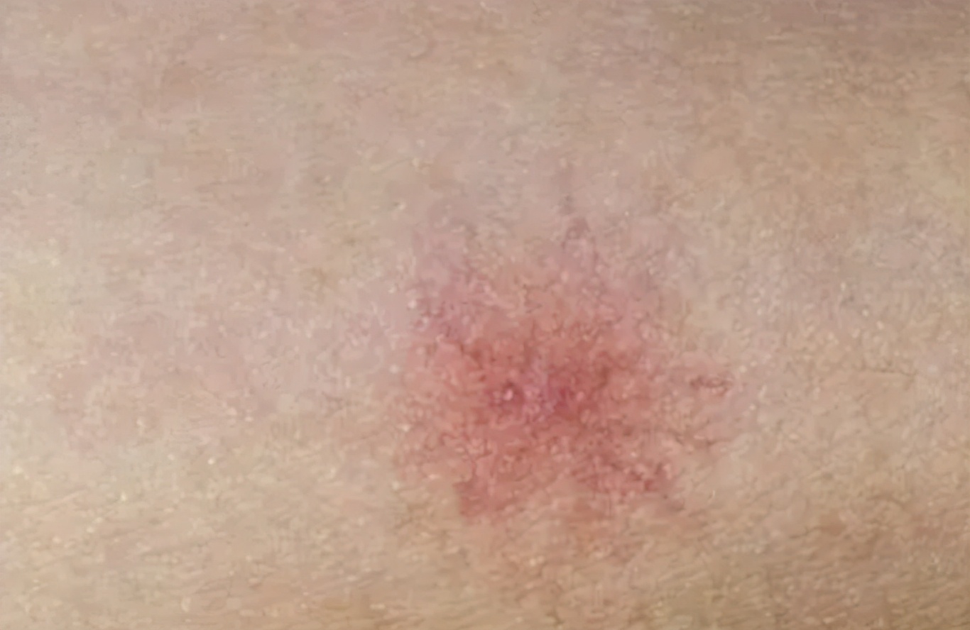 土家九妹|晨起若有3个“表现”,八成是肝脏变硬,若一个不占,肝还比较轻松