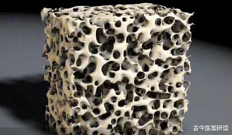 古今医案研读|吃一口相当于喝13杯星巴克，骨科医生：若你经常吃，小心骨骼如“蜂窝”