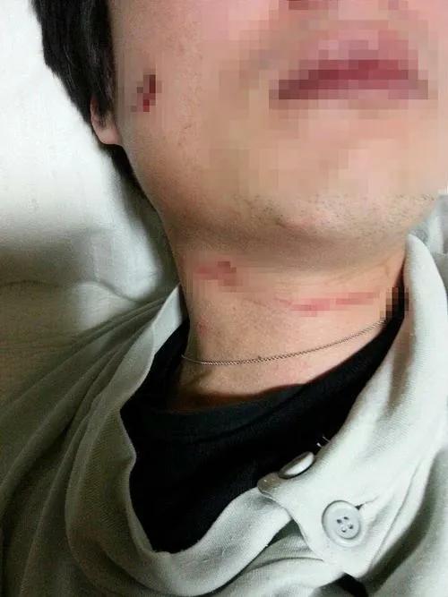 花影爱花 逼丈夫喝尿,踢出睾丸破裂,拿剪刀戳人,韩国财阀之女有多嚣张?