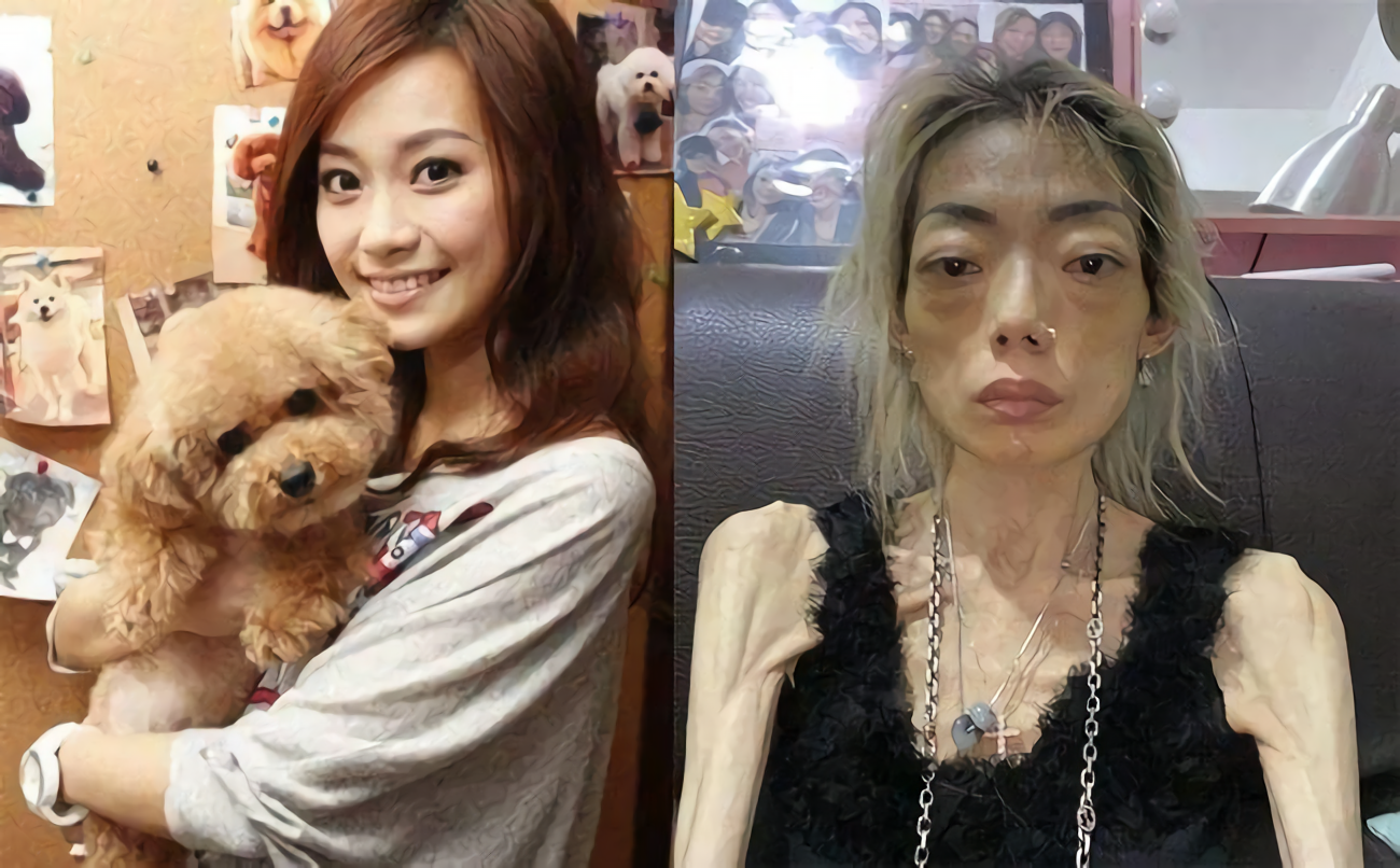 超模|22岁甜美名模嫁入豪门,8年被折磨成“骷髅人”,惨遭扫地出门