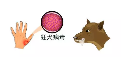 |被鸡、兔子、老鼠、人咬伤，需不需要打狂犬疫苗？