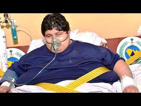 起重机 胖到要靠起重机吊出门的胖少年,居然从610kg减到63kg,减掉半吨