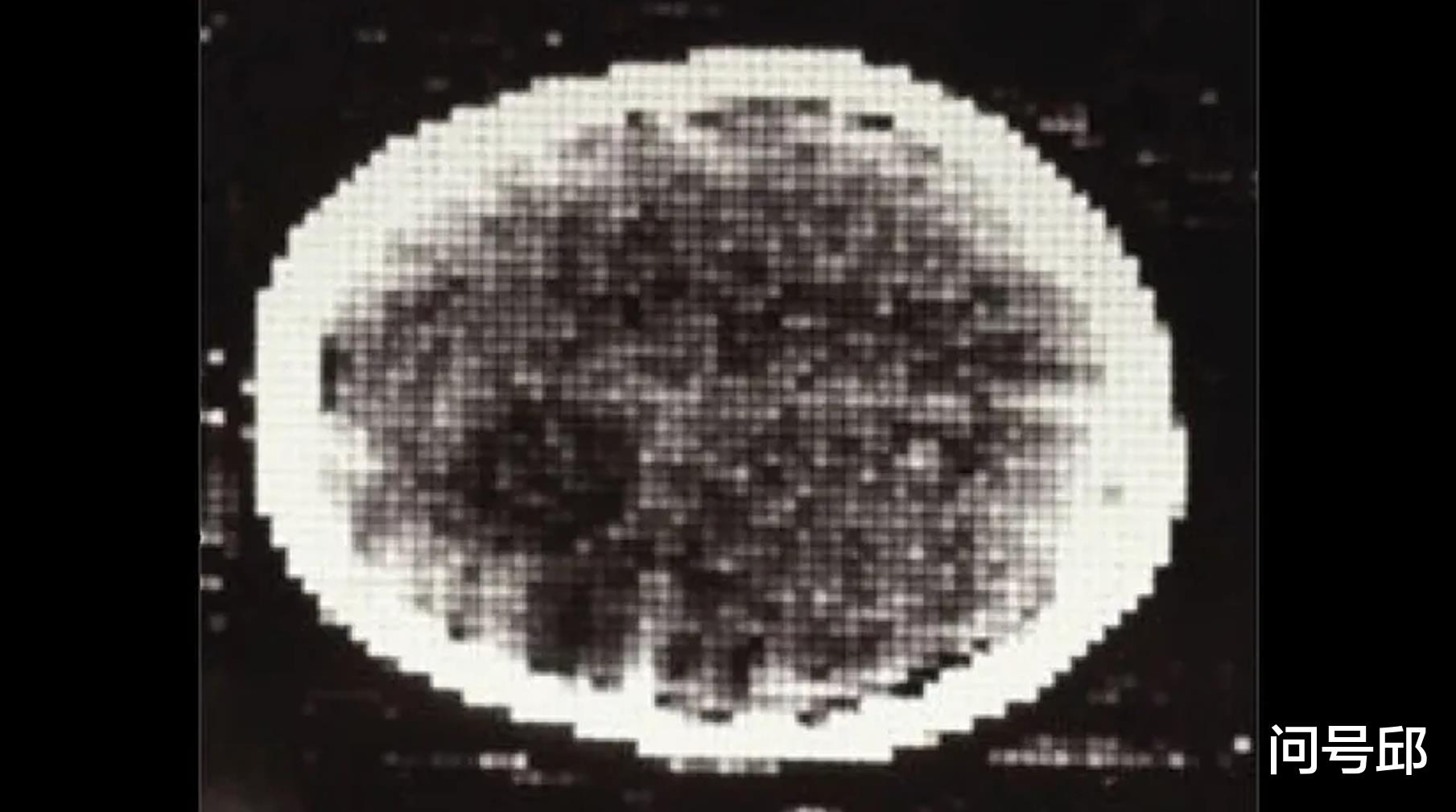 扫描仪 第一台CT扫描仪的诞生，标志着医学技术的革新具有里程碑意义