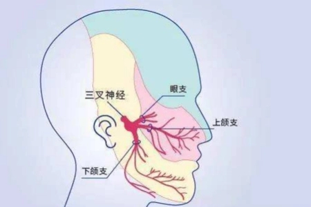 麦吉科普 世界上最疼的病，你知道是什么吗？经历过的都是“超人”