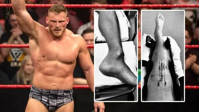 wwe|嘴炮康納斷腳太可怕？盤點WWE歷史上六大斷腿慘案，最后一個慎入
