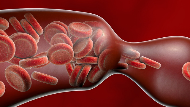 血栓|体内有栓，手脚一般会出现4个症状，占的越多，血管堵得越严重