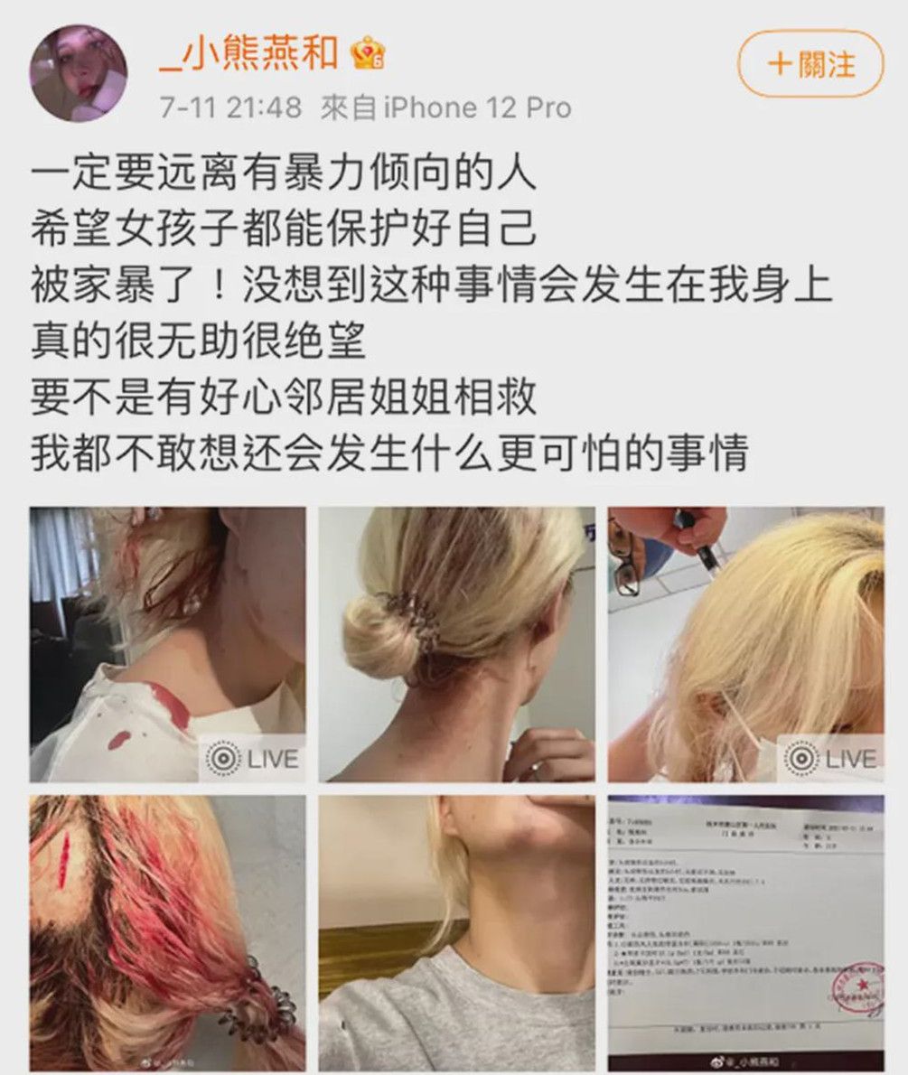 旺旺屋|被砍女硕士案细节曝光，男人的保证书，别信