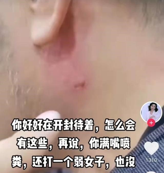 开封舅舅私闯金果儿民宅被打,金果儿纯属自卫?提前找叔叔备过案