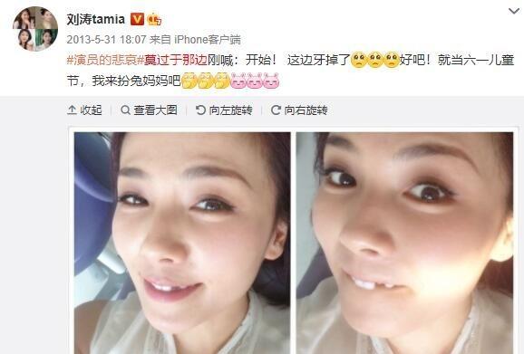 刘涛|明星“假牙”大pk：刘涛花300万整牙，吴昕的牙齿变黢黑