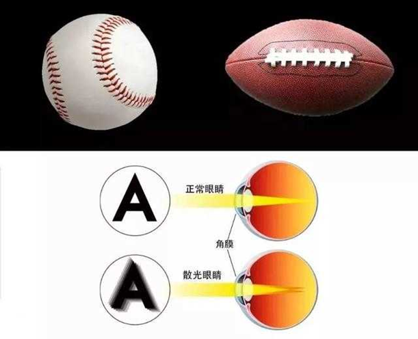 视界沐光VR视力|散光是怎么回事? 和近视一样吗? 今天就帮你弄明白