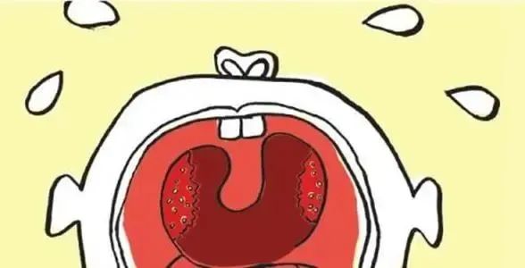 耳鼻喉申医生|秋季高发！如果你有咽干、咽痒、吞咽异物感，十有八九已中招！