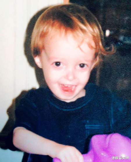 菠萝蜜|苏格兰少年患罕见疾病，全球仅12例，骨瘦如柴永远长不胖