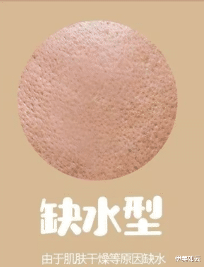伊美如云|毛孔粗大并不只是因为出油?五招教你彻底告别“世纪难题”