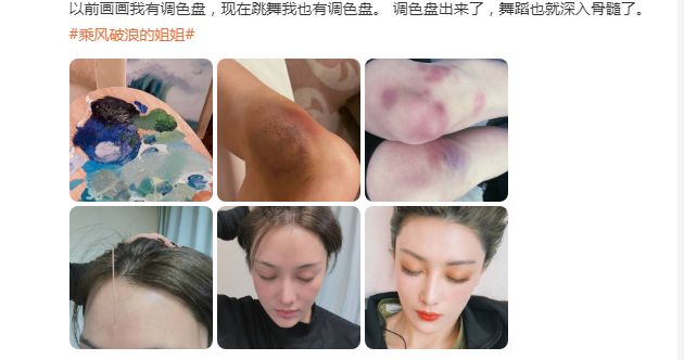 张馨予|张馨予后知后觉，感叹自己当时跳的拖拉机舞：现在看来居然有点二